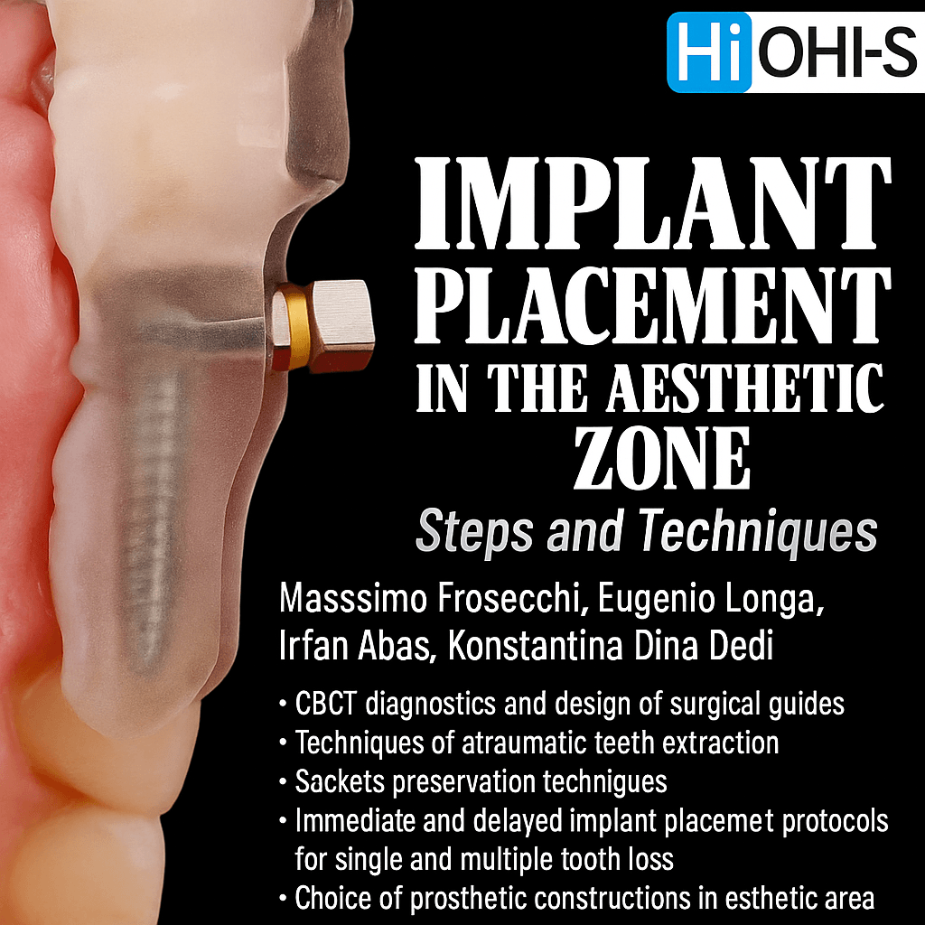 Implant Placement in the Aesthetic Zone: Steps and Technique