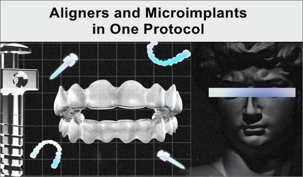 Aligners and Microimplants in One Protocol