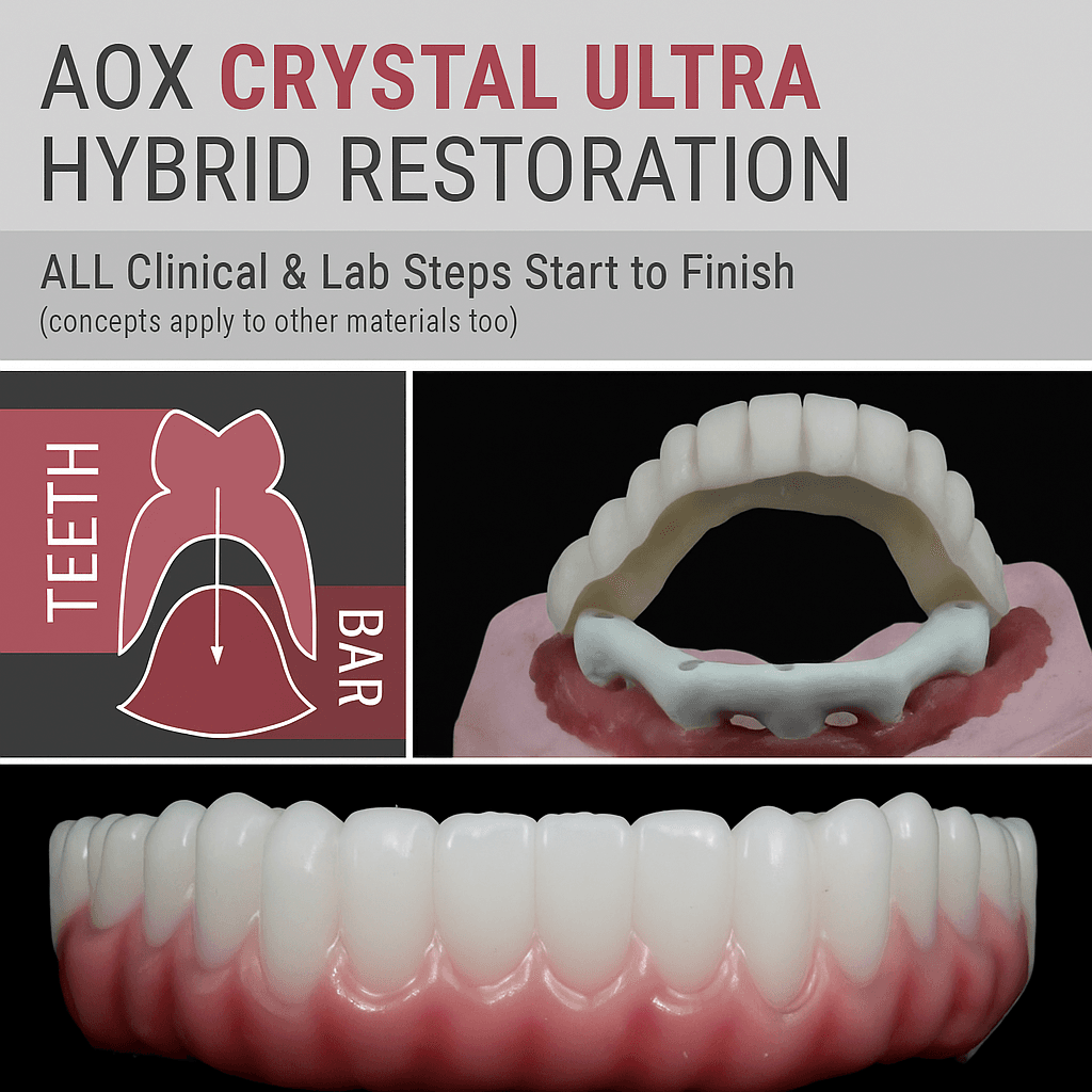 AOX Crystal Ultra Hybrid Restoration – ALL Clinical & Lab Steps Start to Finish
