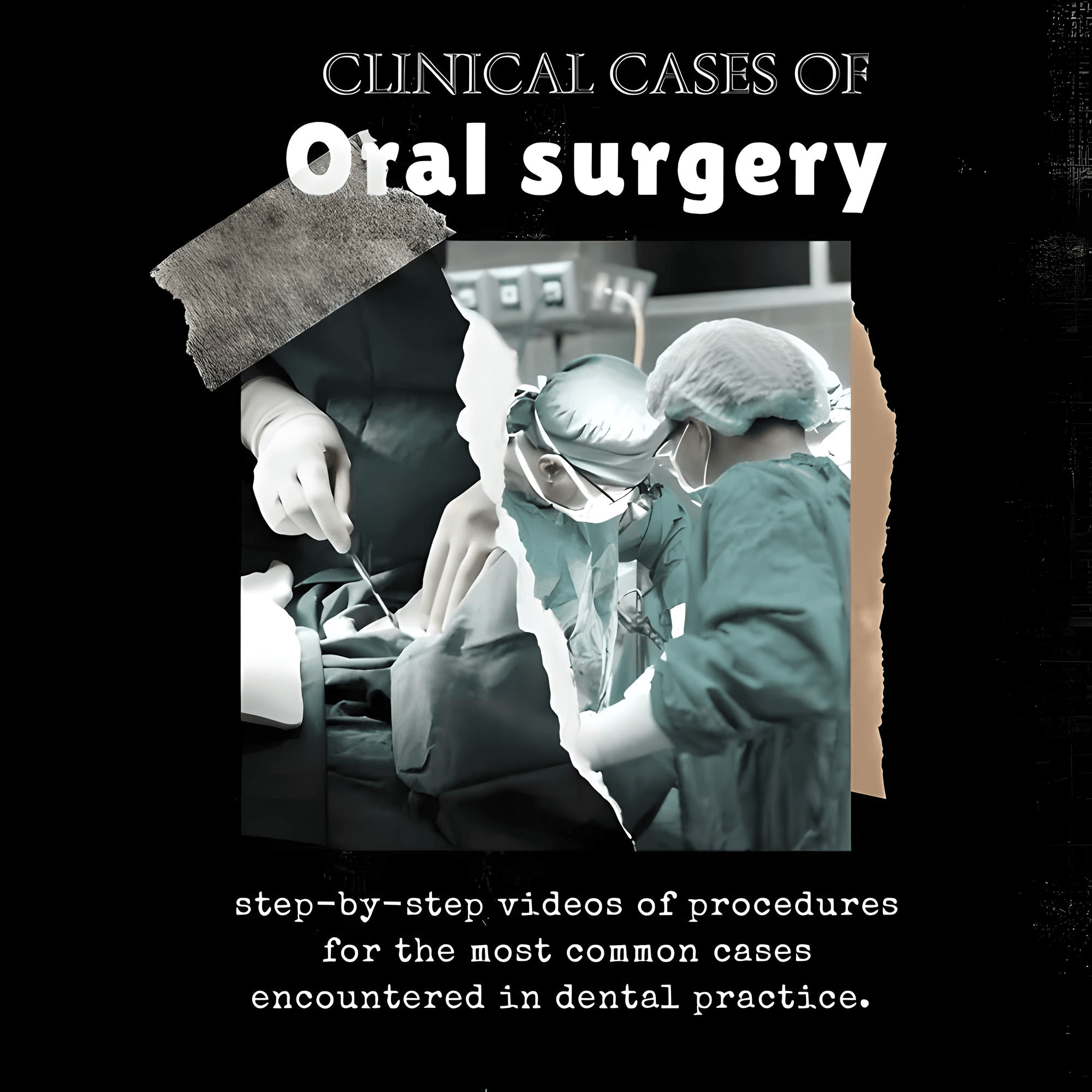 Clinical Cases of Oral Surgery