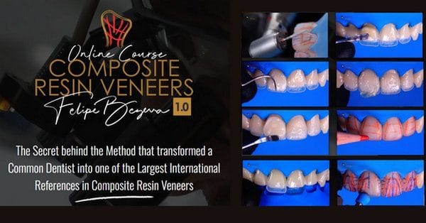 Composite Resin Veneers Course