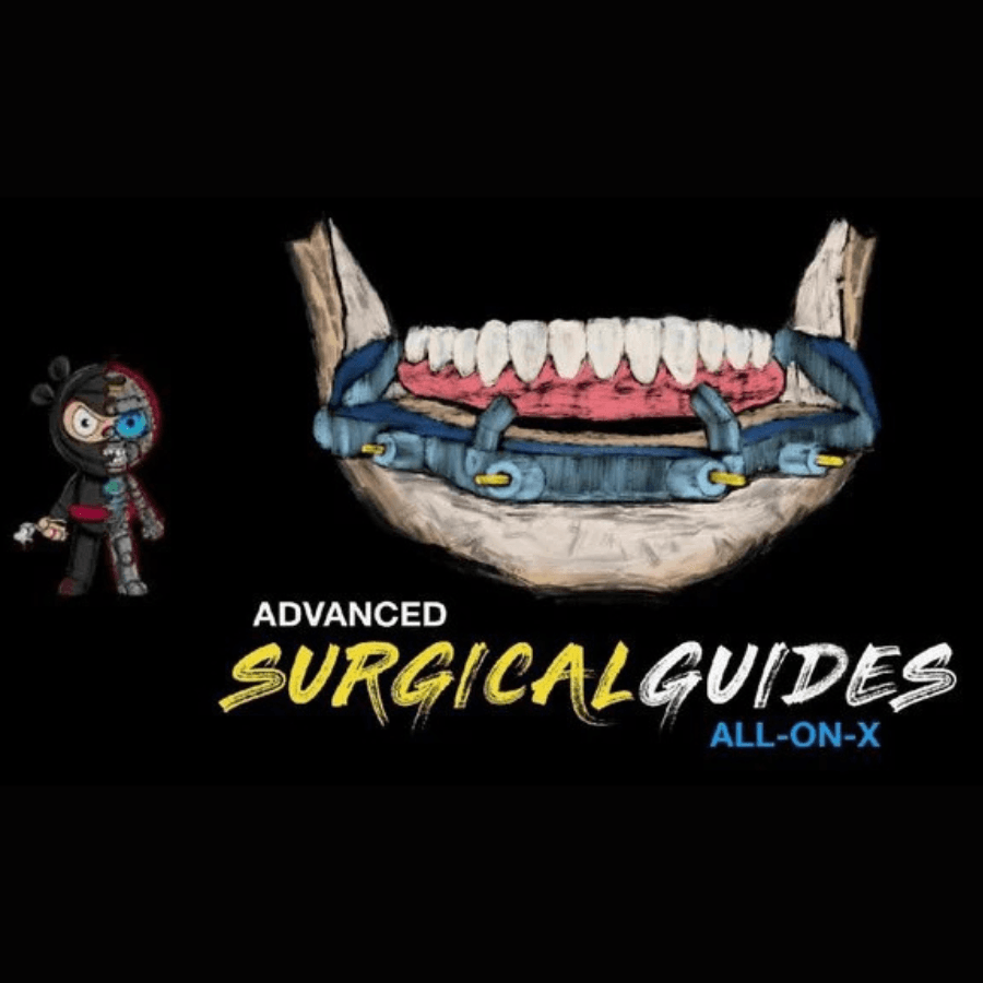 Implant Ninja, Advanced Surgical Guides – All on X