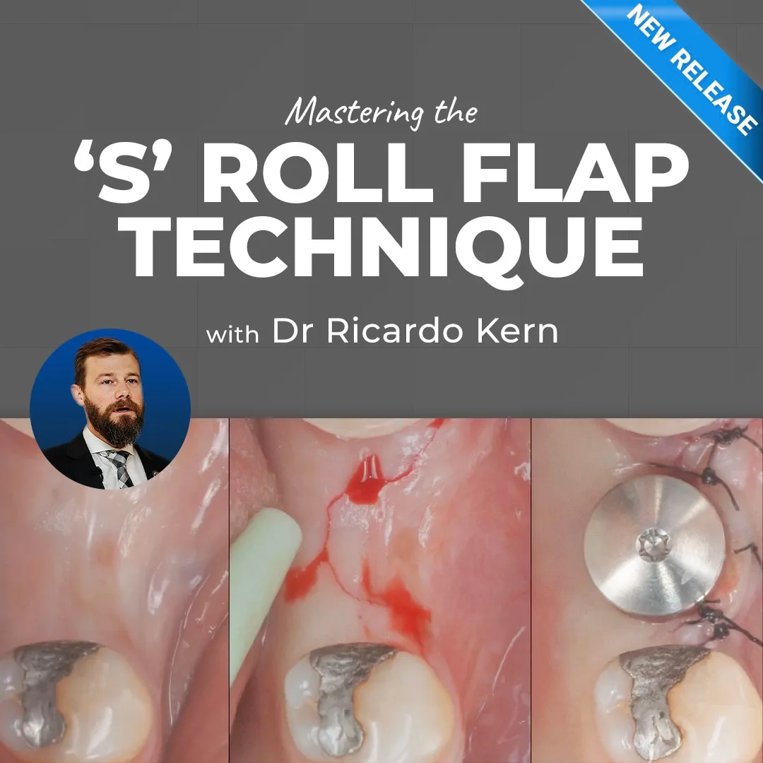 The S Roll Flap Technique