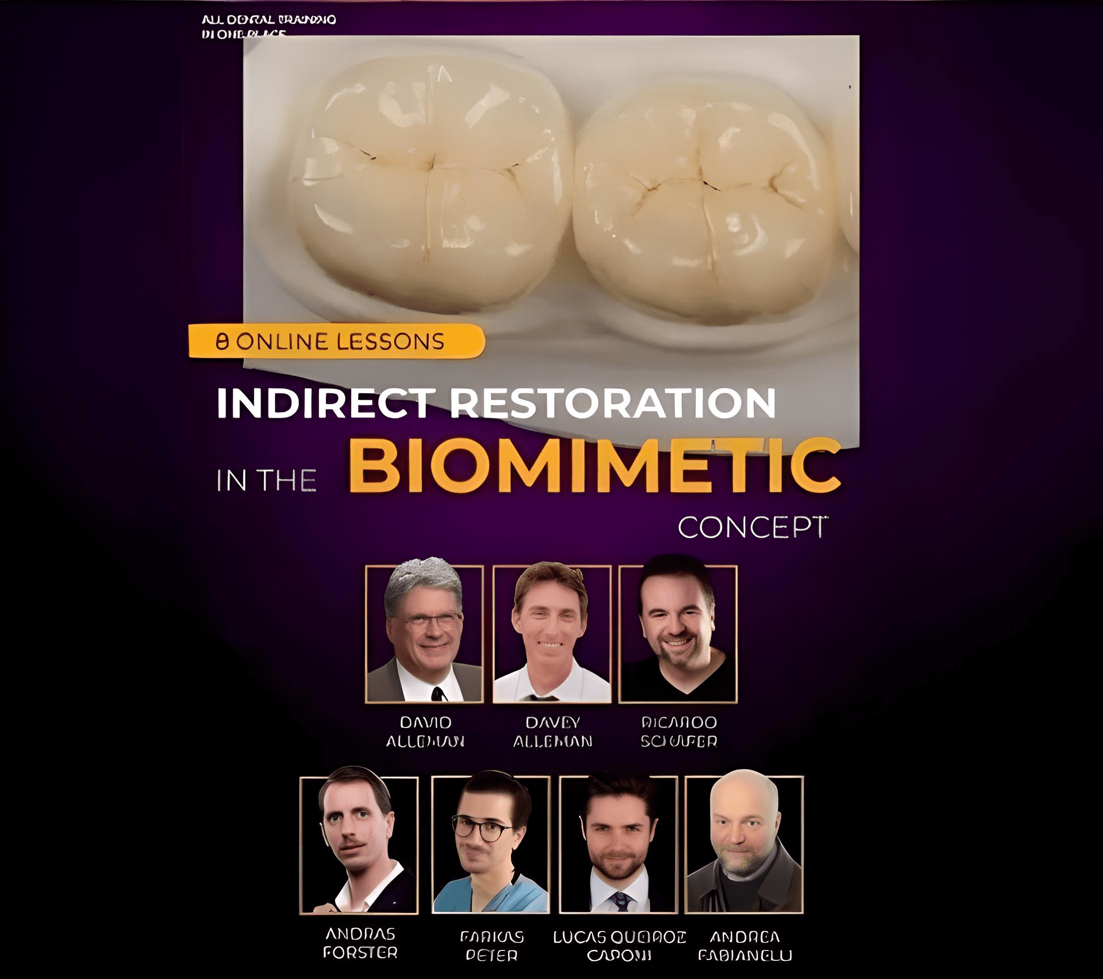 Indirect Restoration in the Biomimetic Concept