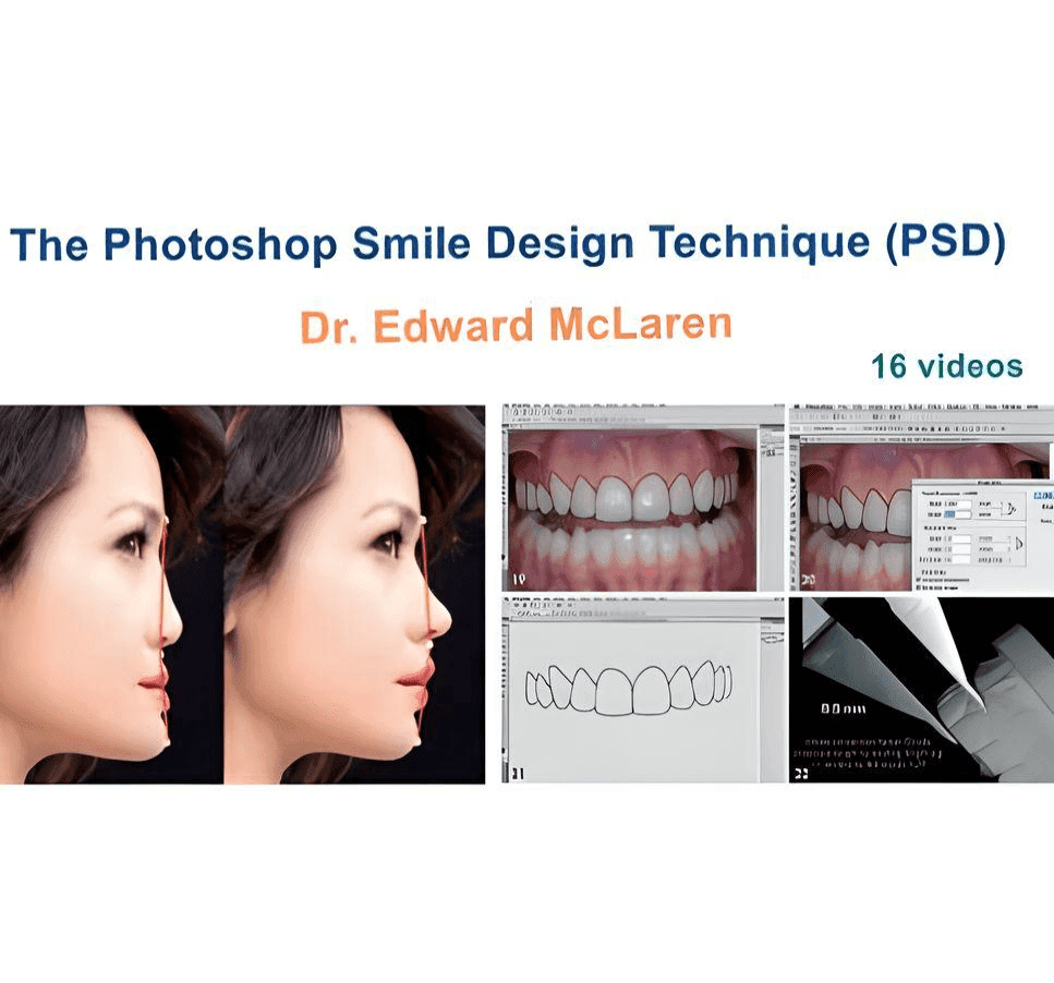 The Photoshop Smile Design Technique (PSD)