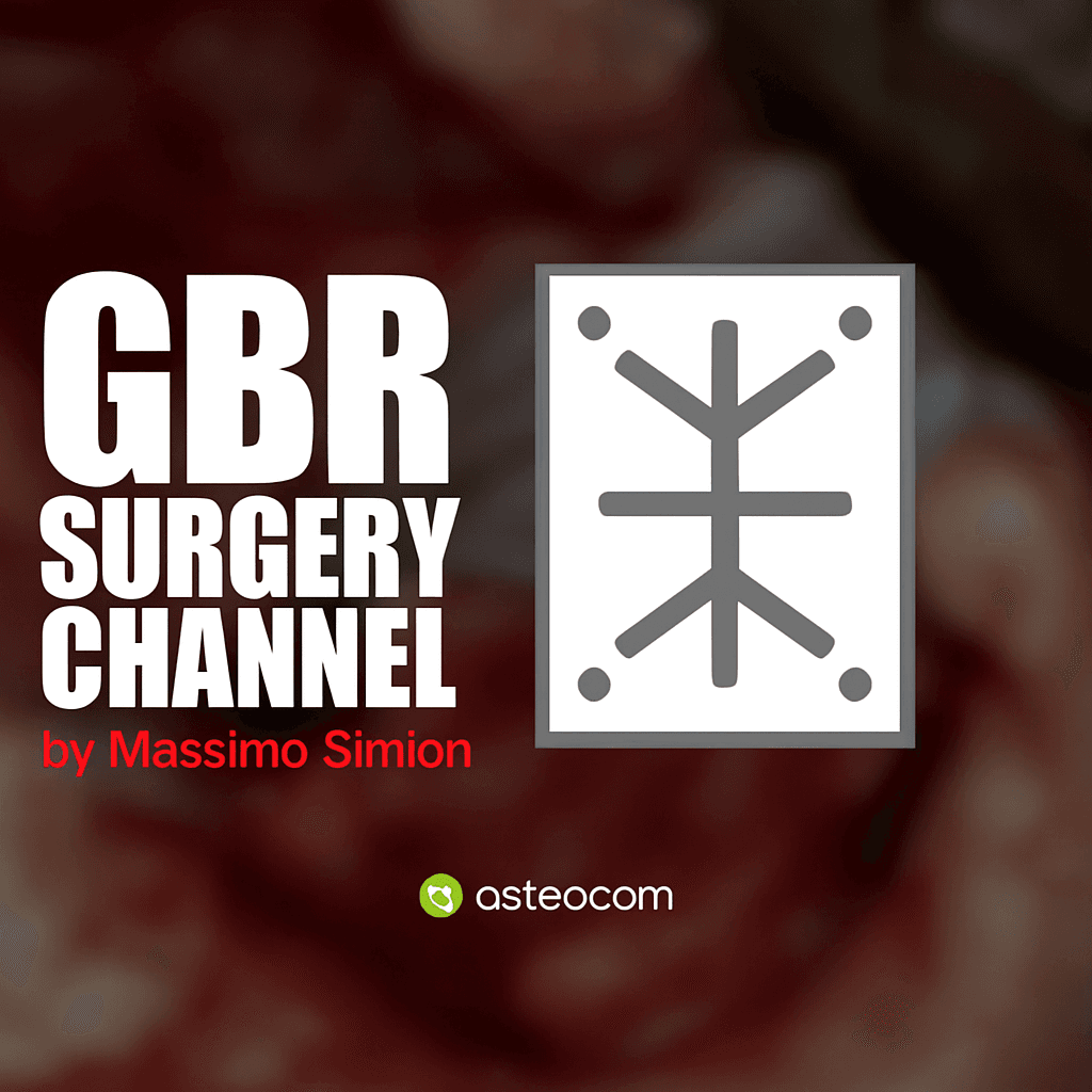 Osteocom GBR Surgery Channel (International) – Massimo Simion