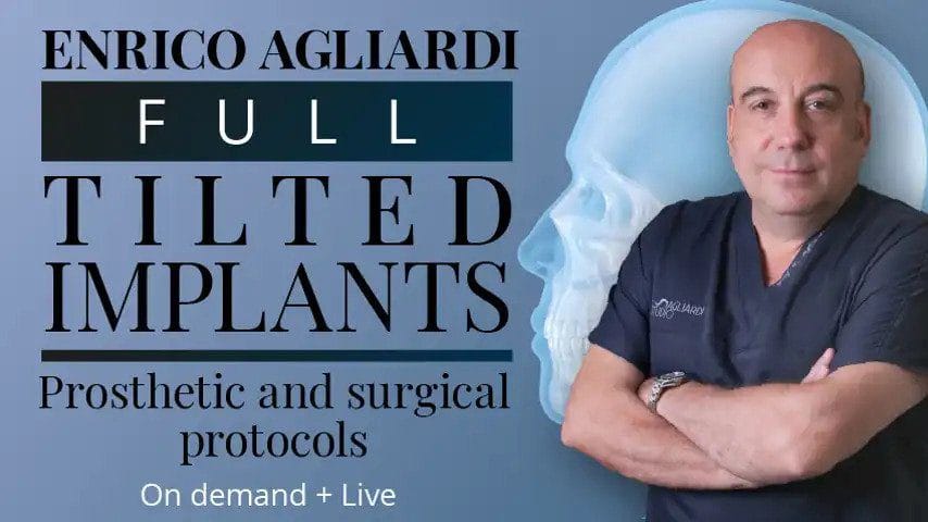 Full tilted implants: Prosthetic and Surgical protocols​