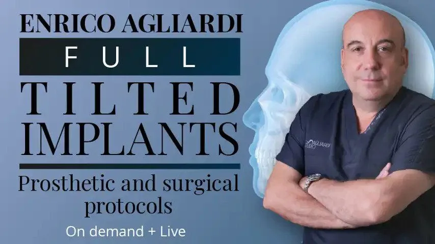 Full tilted implants: Prosthetic and Surgical protocols​