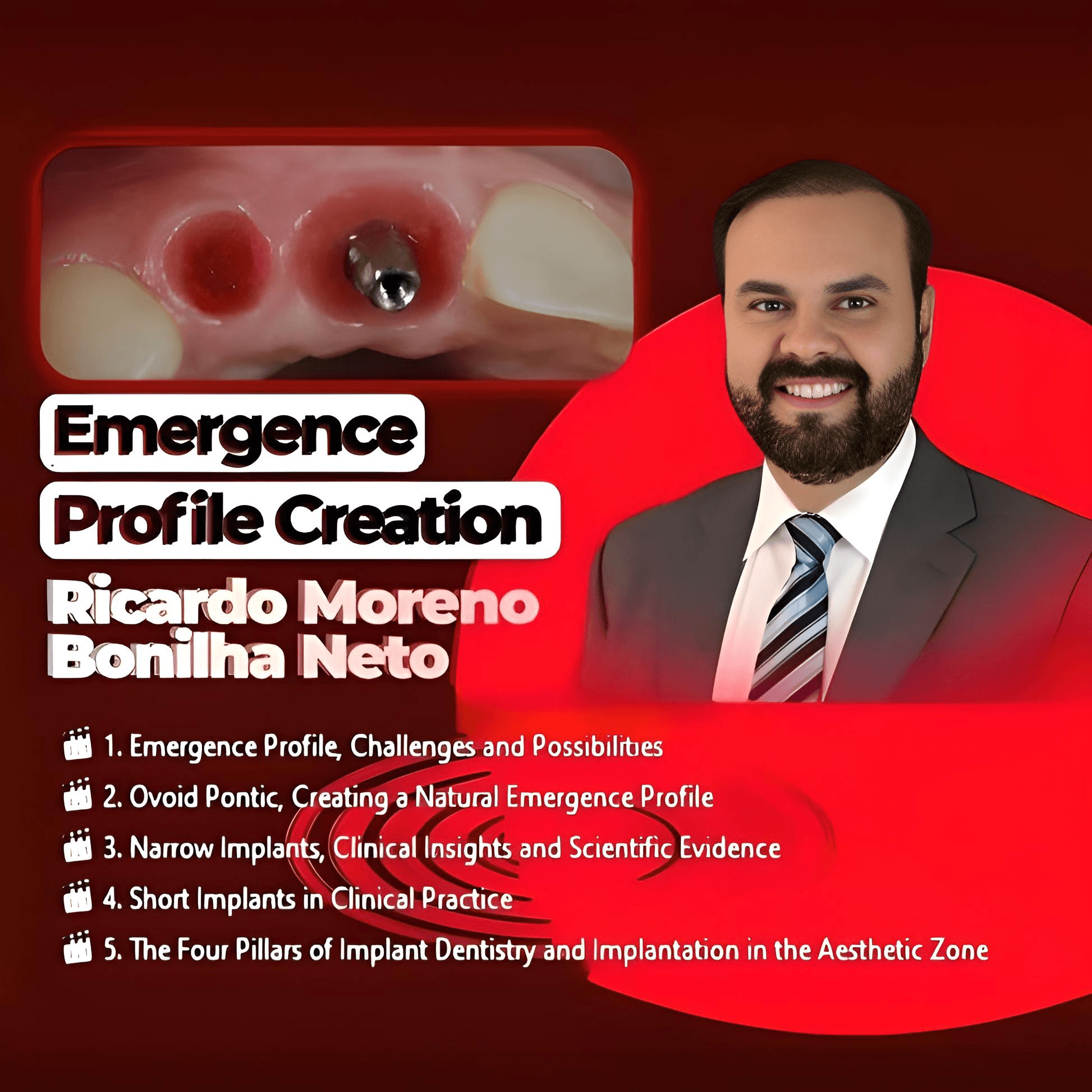 Emergence Profile Creation. Biologically Driven Implantology