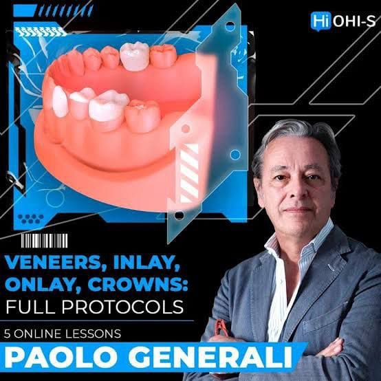 Veneers, inlay, onlay, crowns: full protocols (Videos)