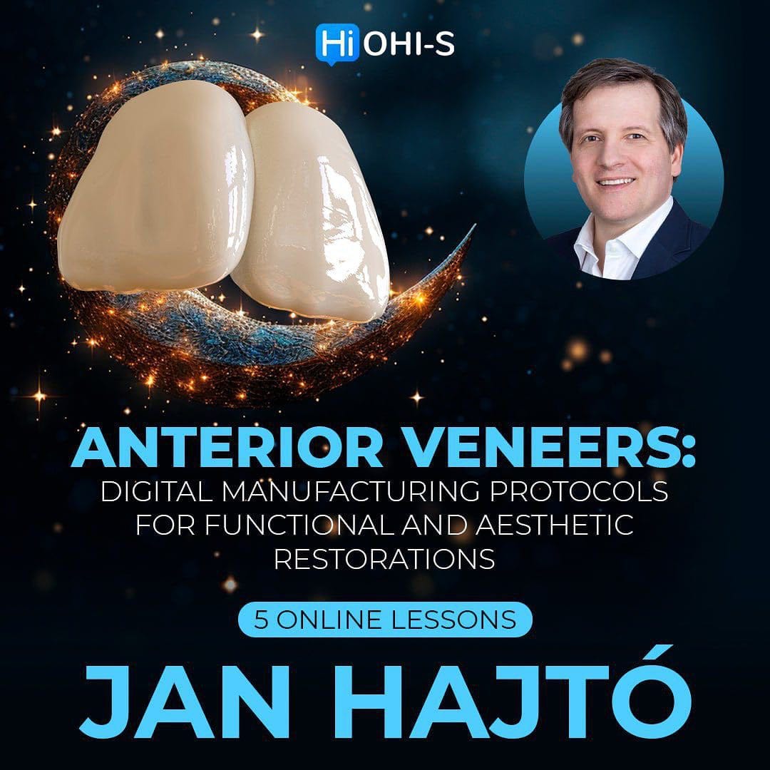 Anterior veneers: Digital manufacturing protocols for functional and aesthetic restorations