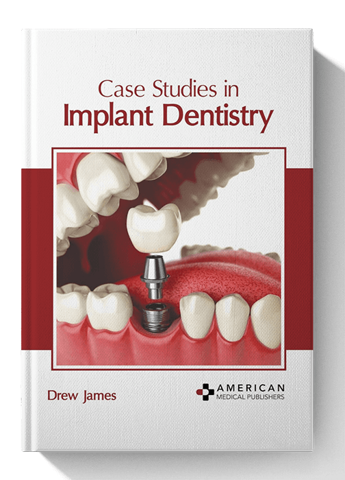 Case Studies in Implant Dentistry