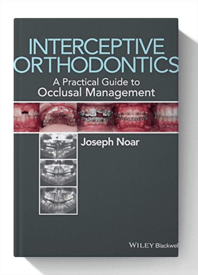 Interceptive Orthodontics: A Practical Guide to Occlusal Management 1st Edition
