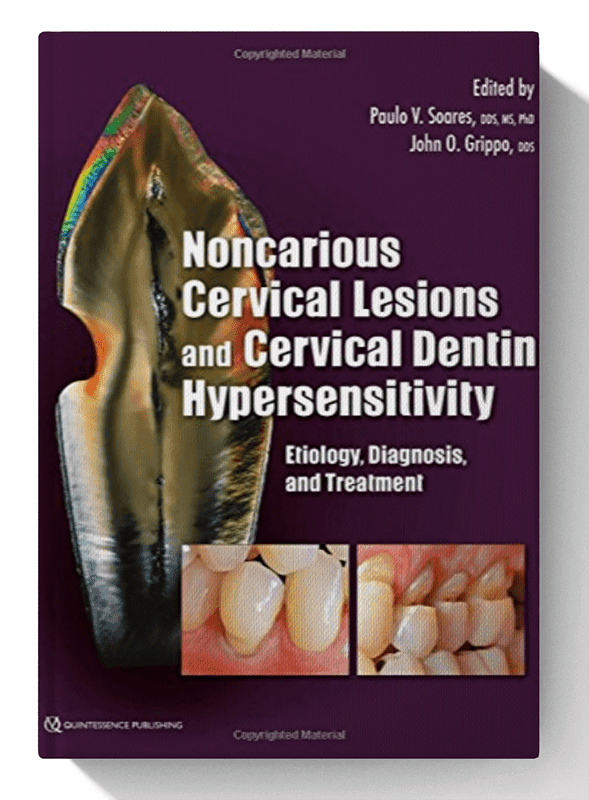 Noncarious Cervical Lesions and Cervical Dentin Hypersensitivity: Etiology, Diagnosis, and Treatment 1st Edition