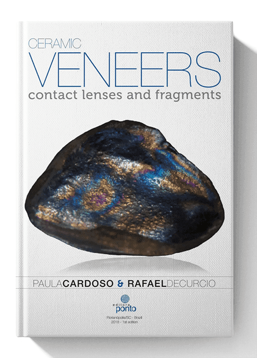 Ceramic Veneers: Contact Lenses and Fragments