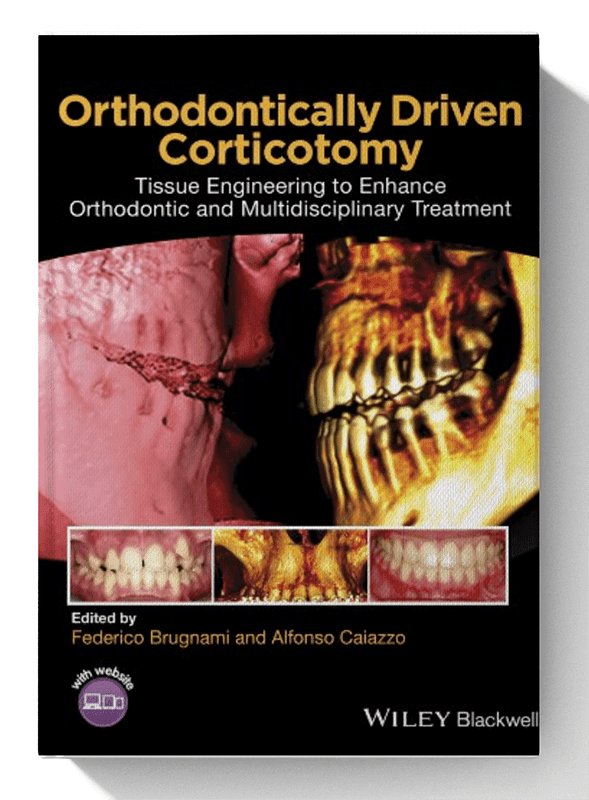 Orthodontically Driven Corticotomy: Tissue Engineering to Enhance Orthodontic and Multidisciplinary Treatment 1st Edition