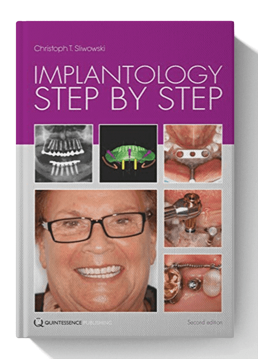 Implantology Step by Step 1st Edition
