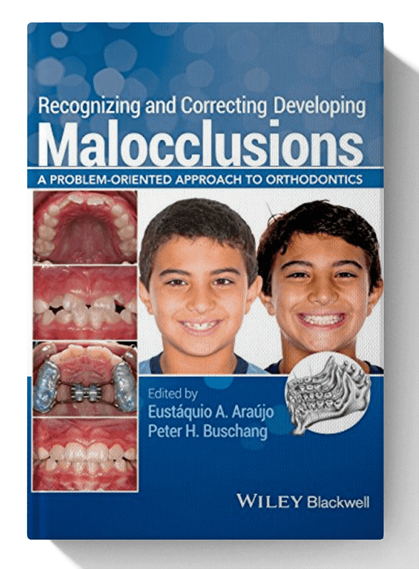 Recognizing and Correcting Developing Malocclusions: A Problem-Oriented Approach to Orthodontics 1st Edition