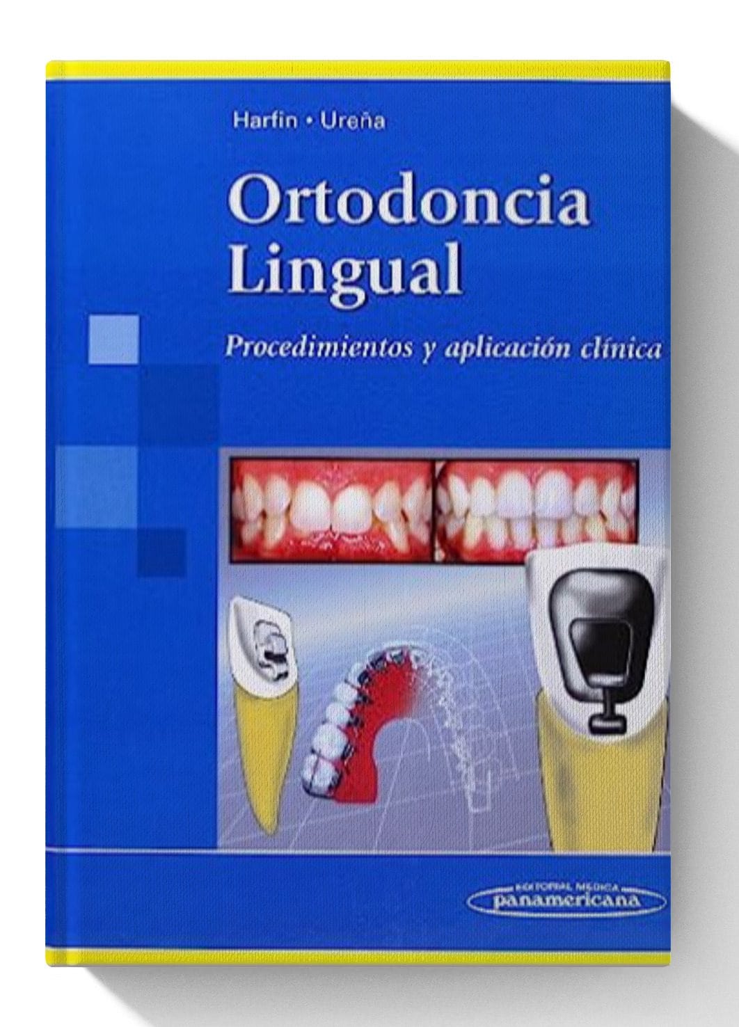 Ortodoncia Lingual: Procedimientos y aplicación clínica