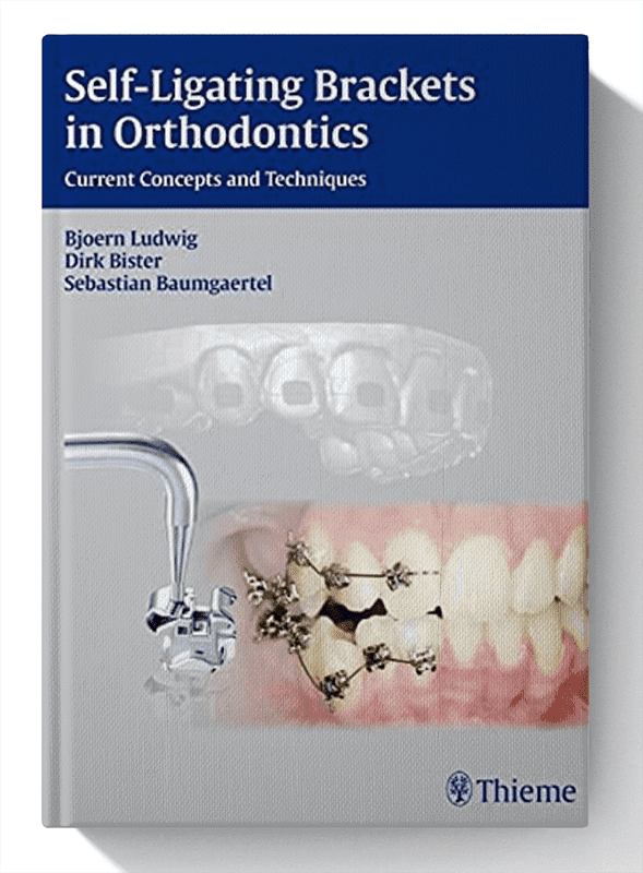 Self-ligating Brackets in Orthodontics: Current Concepts and Techniques 1st Edition