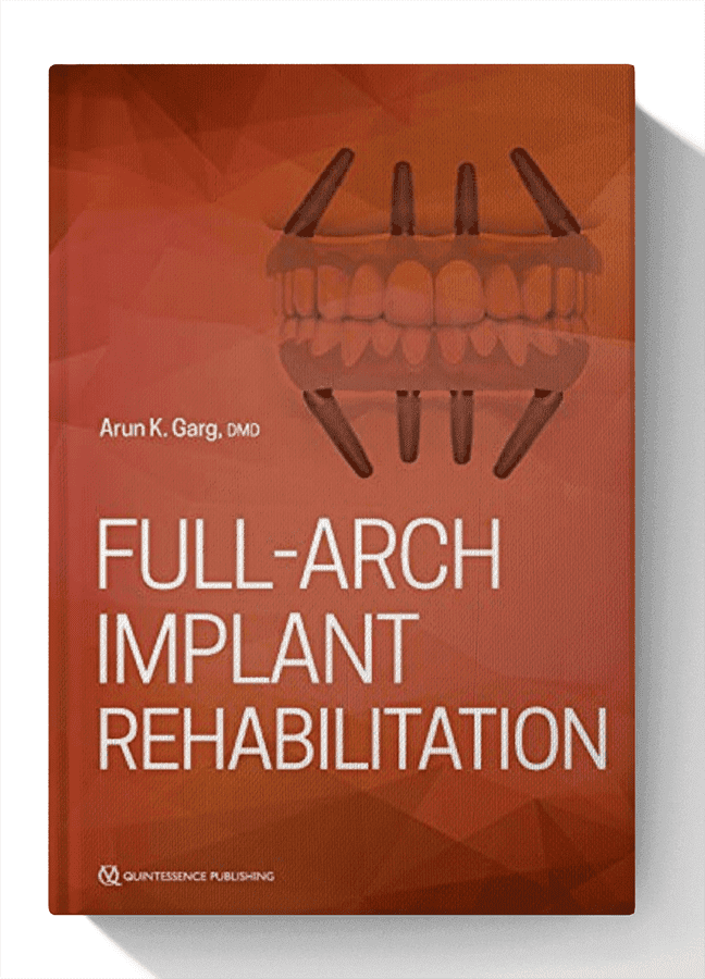 Full-Arch Implant Rehabilitation 1st Edition