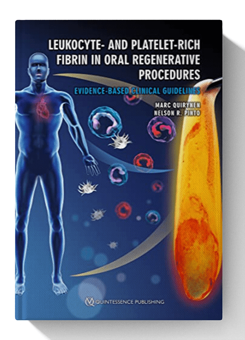 Leukocyte- and Platelet-Rich Fibrin in Oral Regenerative Procedures: Evidence-Based Clinical Guidelines 1st Edition