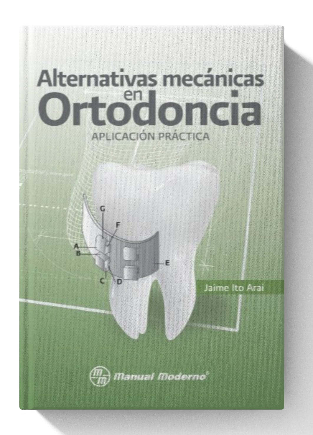 Alternativas mecánicas en ortodoncia. Aplicación práctica
