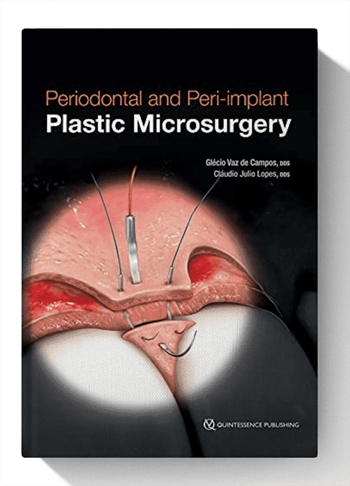 Periodontal and Peri-implant Plastic Microsurgery: Minimally Invasive Techniques with Maximum Precision
