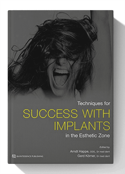 Techniques for Success With Implants in the Esthetic Zone 1st Edition
