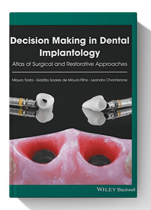 Decision Making in Dental Implantology: Atlas of Surgical and Restorative Approaches 1st Edition
