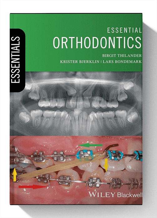 Essential Orthodontics (Essentials (Dentistry)) 1st Edition