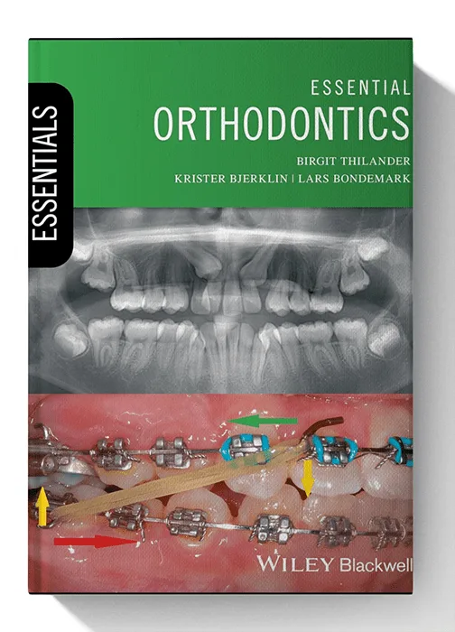 Essential Orthodontics (Essentials (Dentistry)) 1st Edition