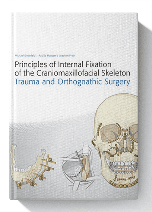 Principles of Internal Fixation of the Craniomaxillofacial Skeleton: Trauma and Orthognathic Surgery 1st Edition
