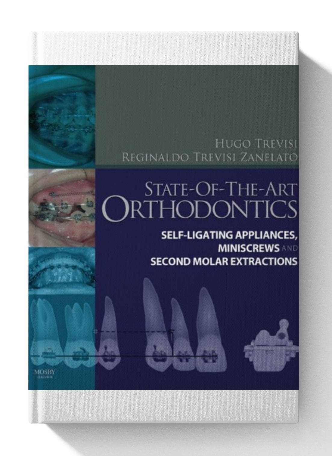 State-of-the-Art Orthodontics E-Book 1st Edition