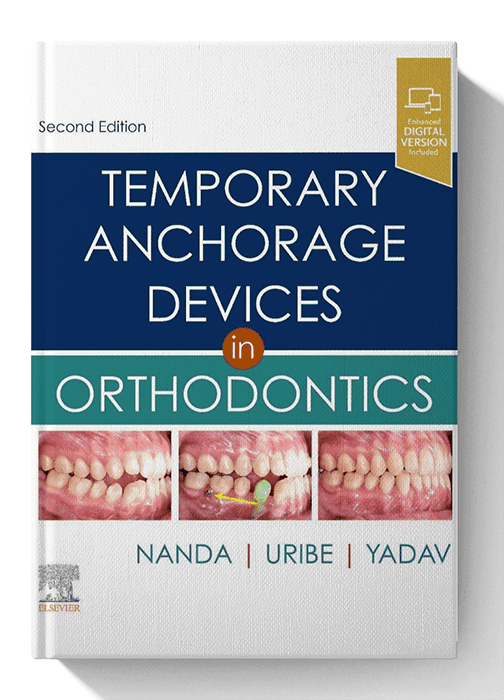 Temporary Anchorage Devices in Orthodontics 2nd Edition