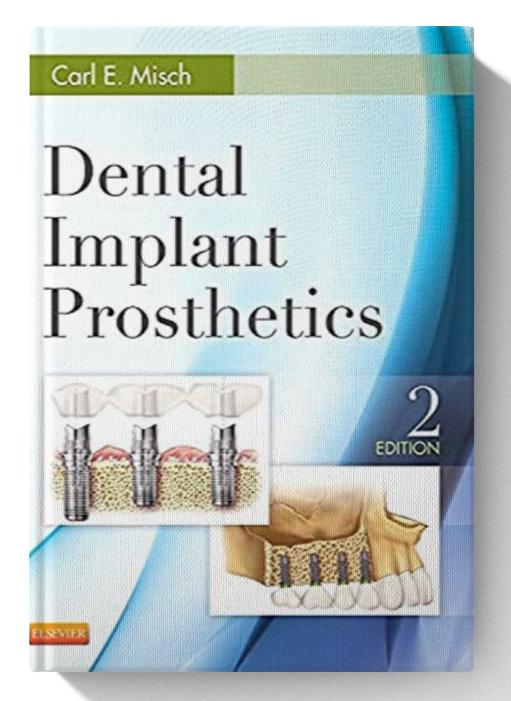 Dental Implant Prosthetics 2nd Edition