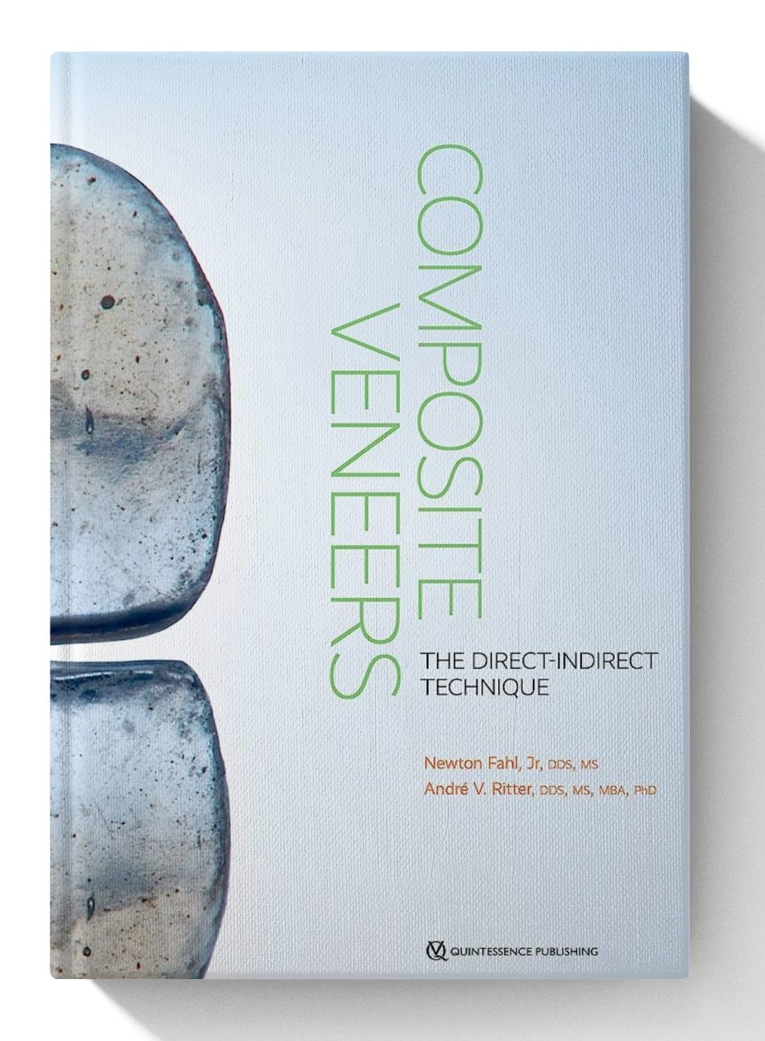 Composite Veneers: The Direct-Indirect Technique (Scanned)