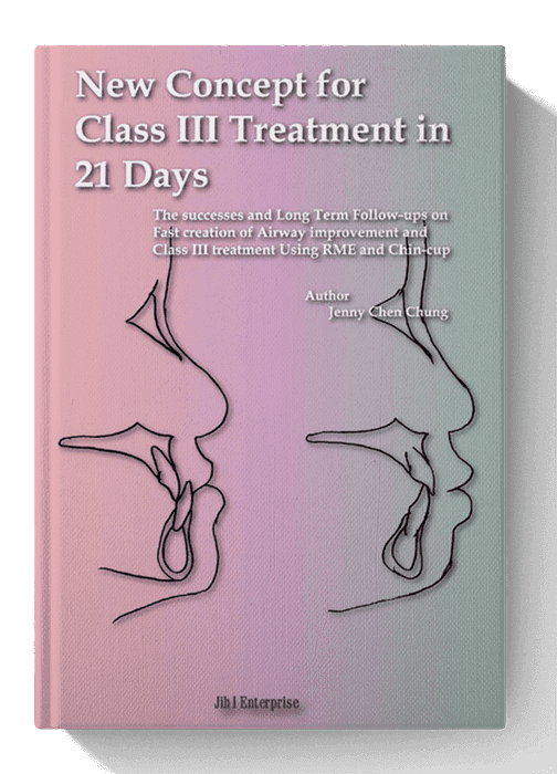 New Concept for Class III Treatment in 21 Days