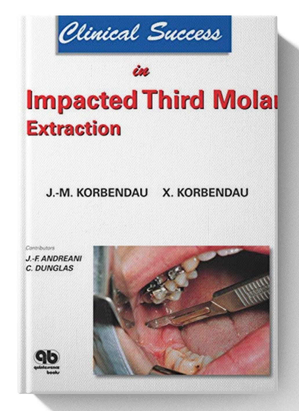 Clinical Success in Impacted Third Molar Extraction