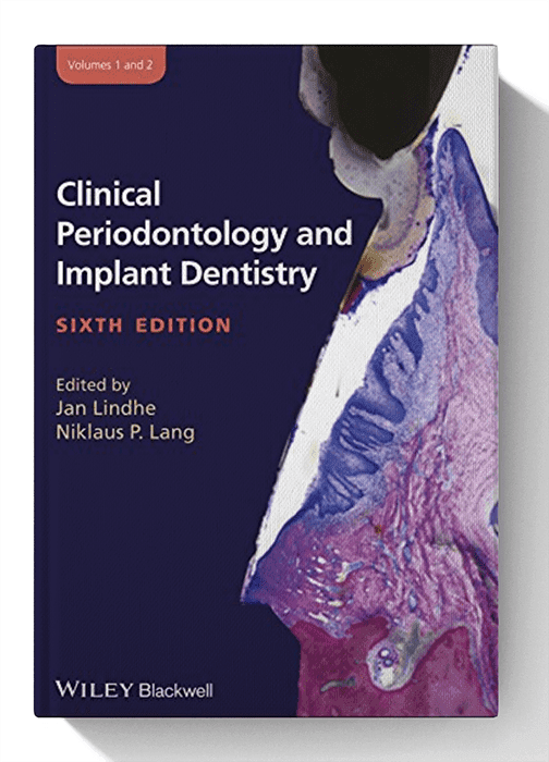 Clinical Periodontology and Implant Dentistry, 2 Volume Set 6th Edition