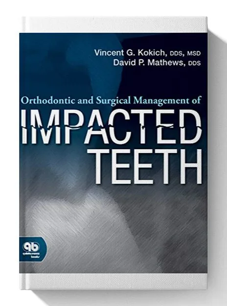 Orthodontic and Surgical Management of Impacted Teeth First Edition