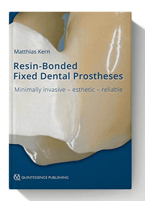 Resin-Bonded Fixed Dental Prostheses: Minimally invasive – esthetic – reliable 1st Edition
