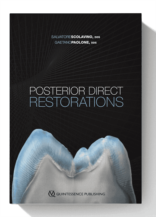 Posterior Direct Restorations 1st Edition