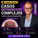 Casos Ortodóncicos Complejos: El Uso de Anclaje Esquelético