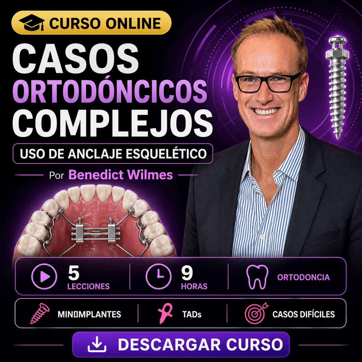 Casos Ortodóncicos Complejos: El Uso de Anclaje Esquelético
