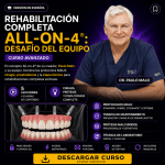 Rehabilitación Completa All-on-4 ®: Desafío del Equipo