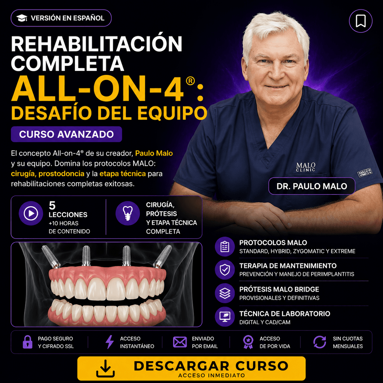 Rehabilitación Completa All-on-4 ®: Desafío del Equipo