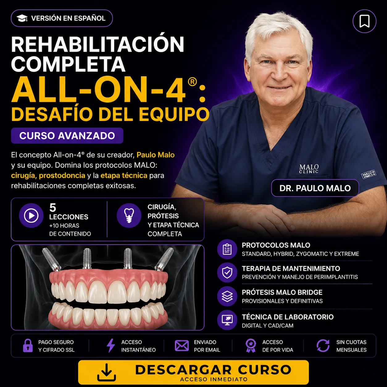 Rehabilitación Completa All-on-4 ®: Desafío del Equipo