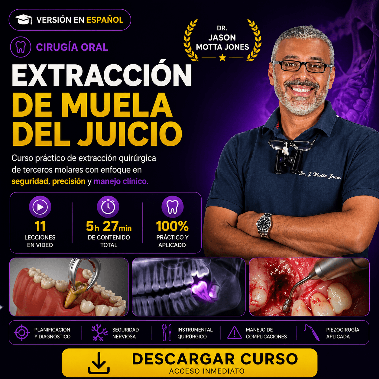 Extracción de Muela del Juicio