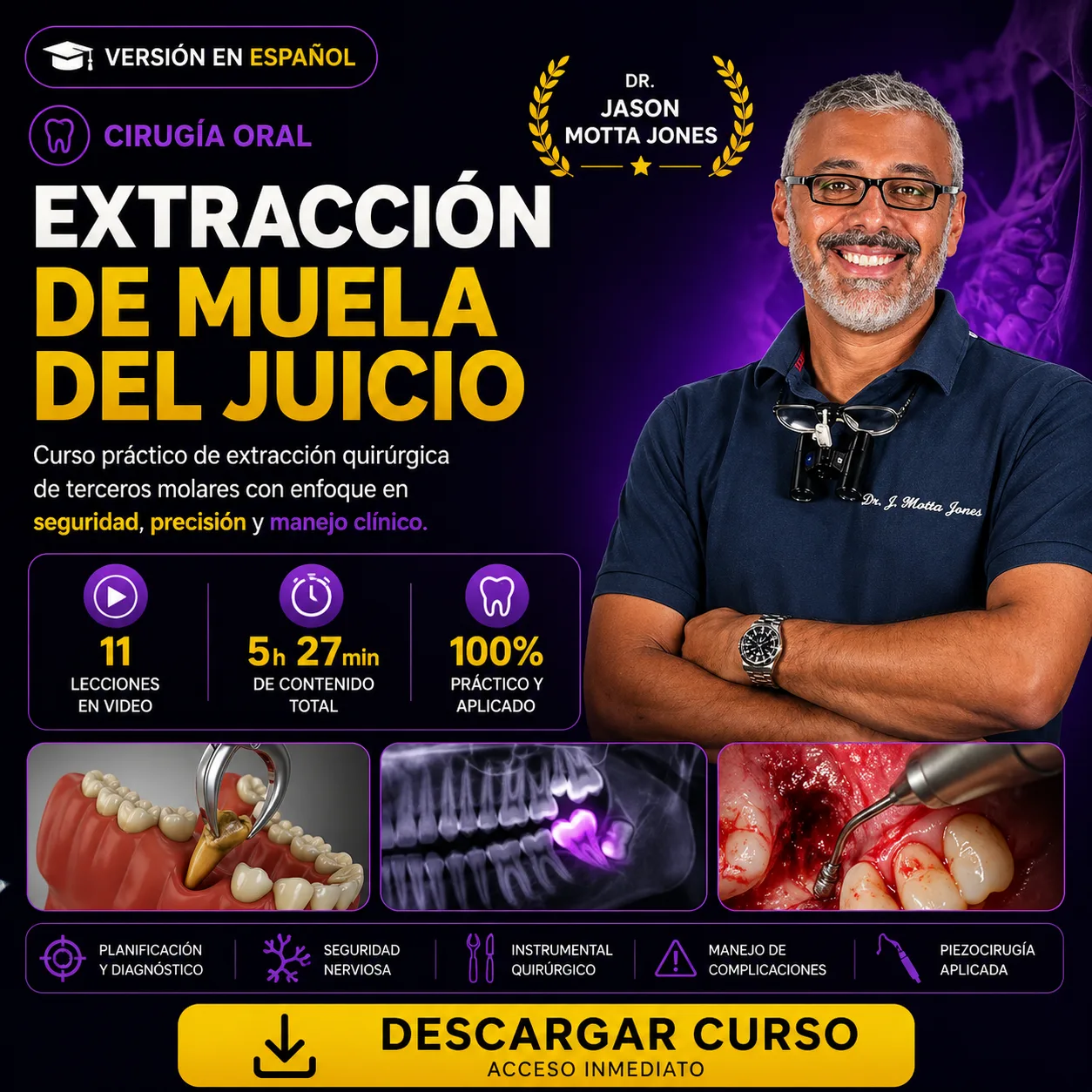 Extracción de Muela del Juicio